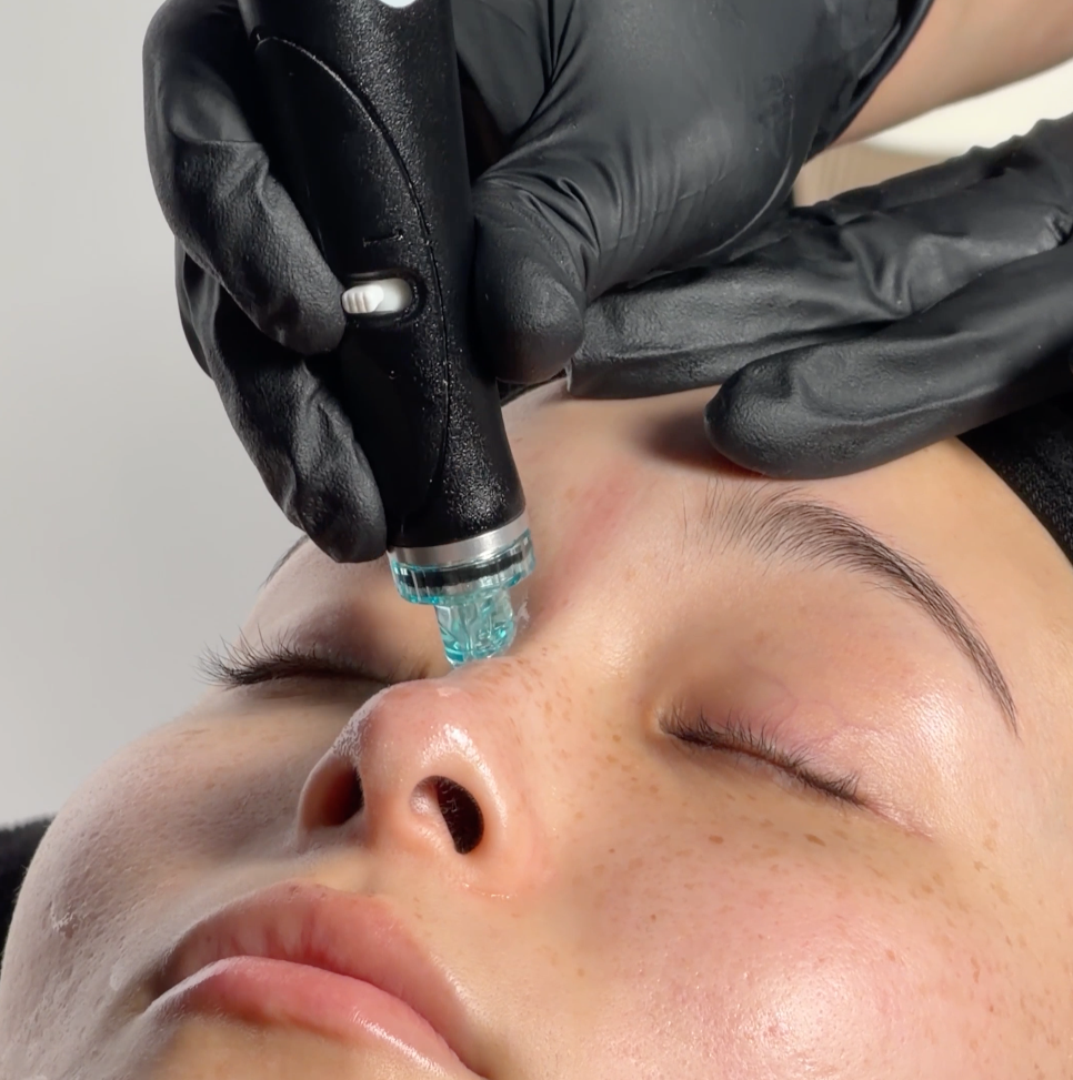 A person receiving a facial treatment with a microcurrent device on their forehead, lying down with closed eyes, while a practitioner in black gloves operates the device.