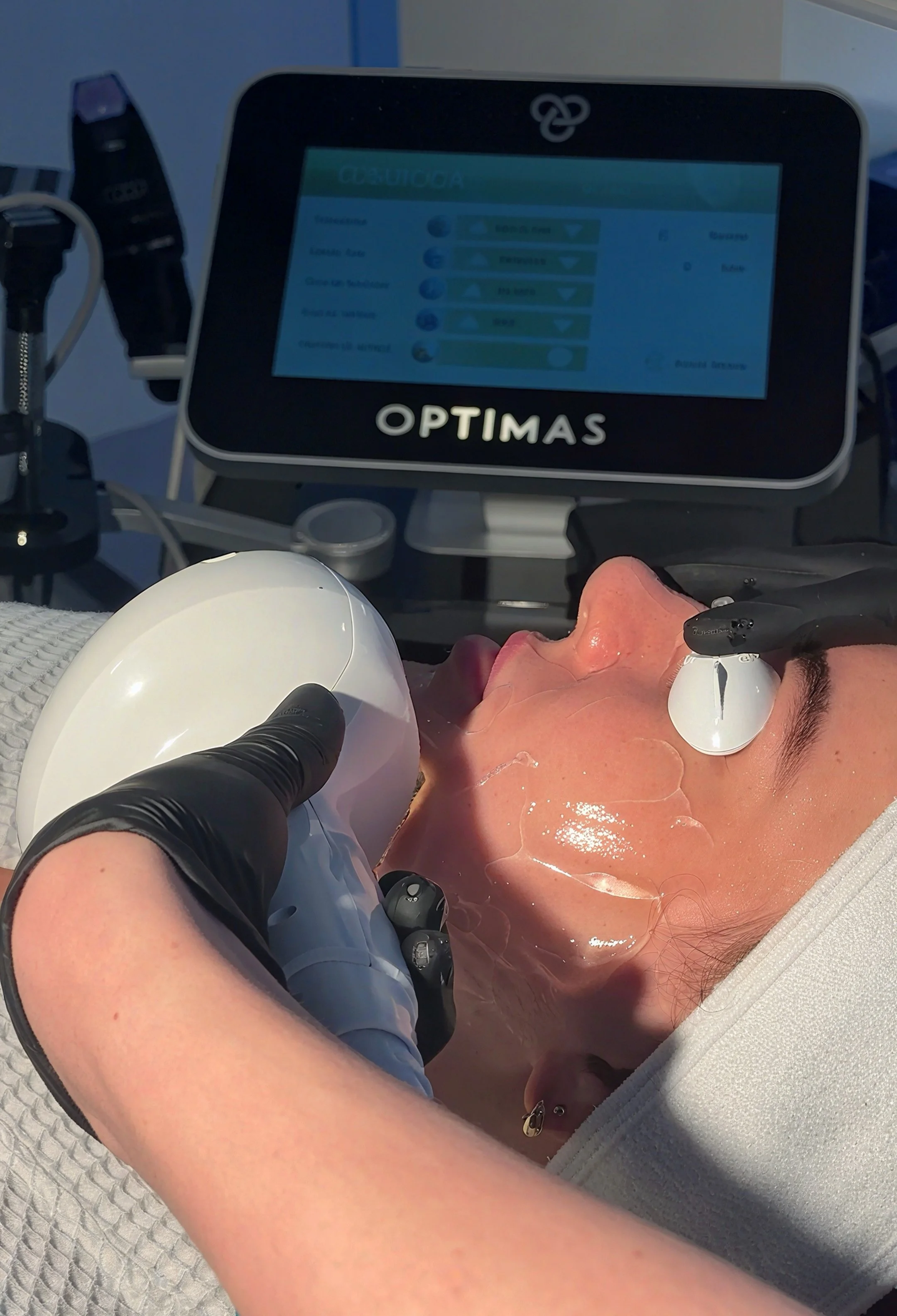 A person lying down with protective eyewear, with a medical or cosmetic device being applied to their face while a healthcare worker in gloves administers a treatment, with a monitor in the background displaying settings.