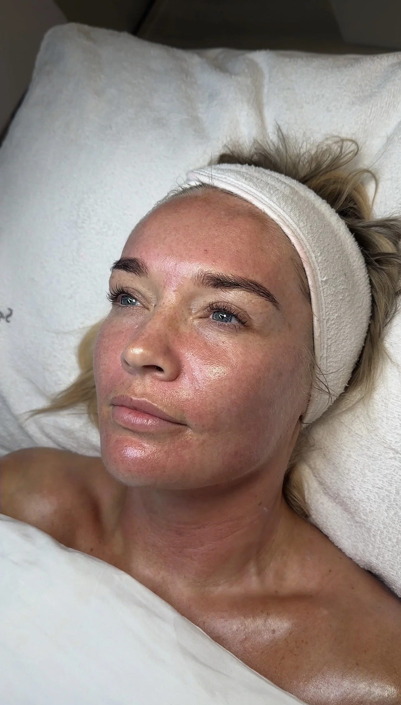 A woman with blonde hair, laying on a pillow, wearing a headband, with glowing, dewy skin.