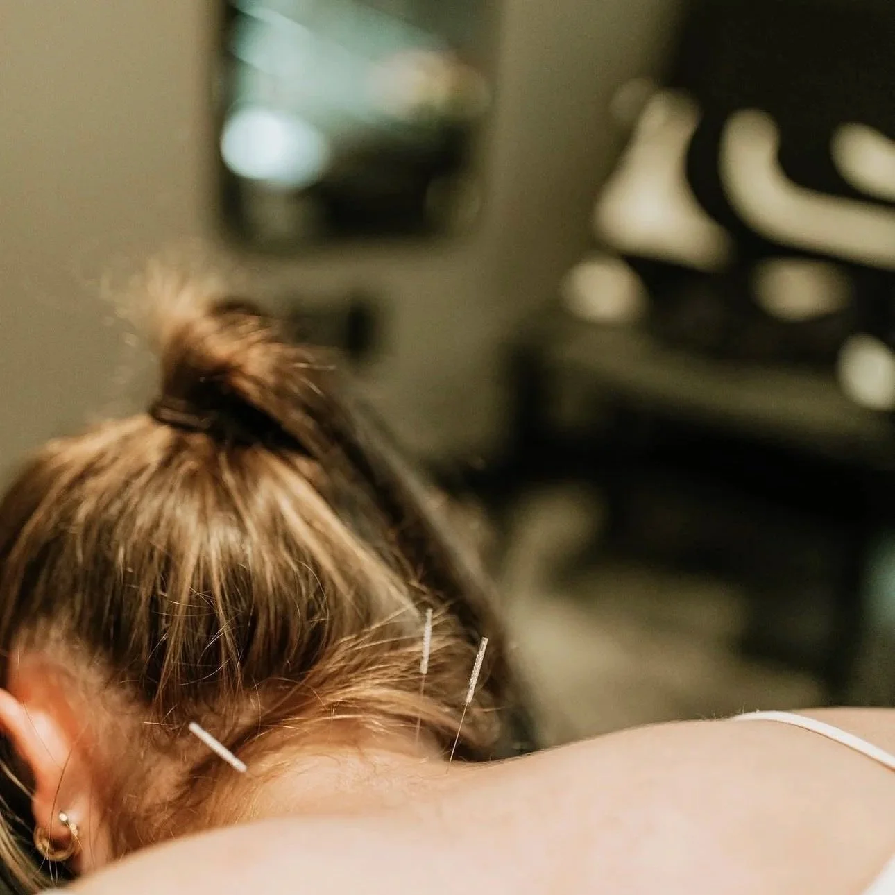 A person getting a massage with acupuncture needles inserted in their skin, with blurred background of a mirror and a stove.