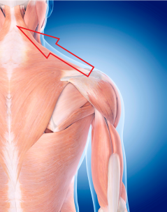 anatomy showing the muscles of the back and where they attach to the neck