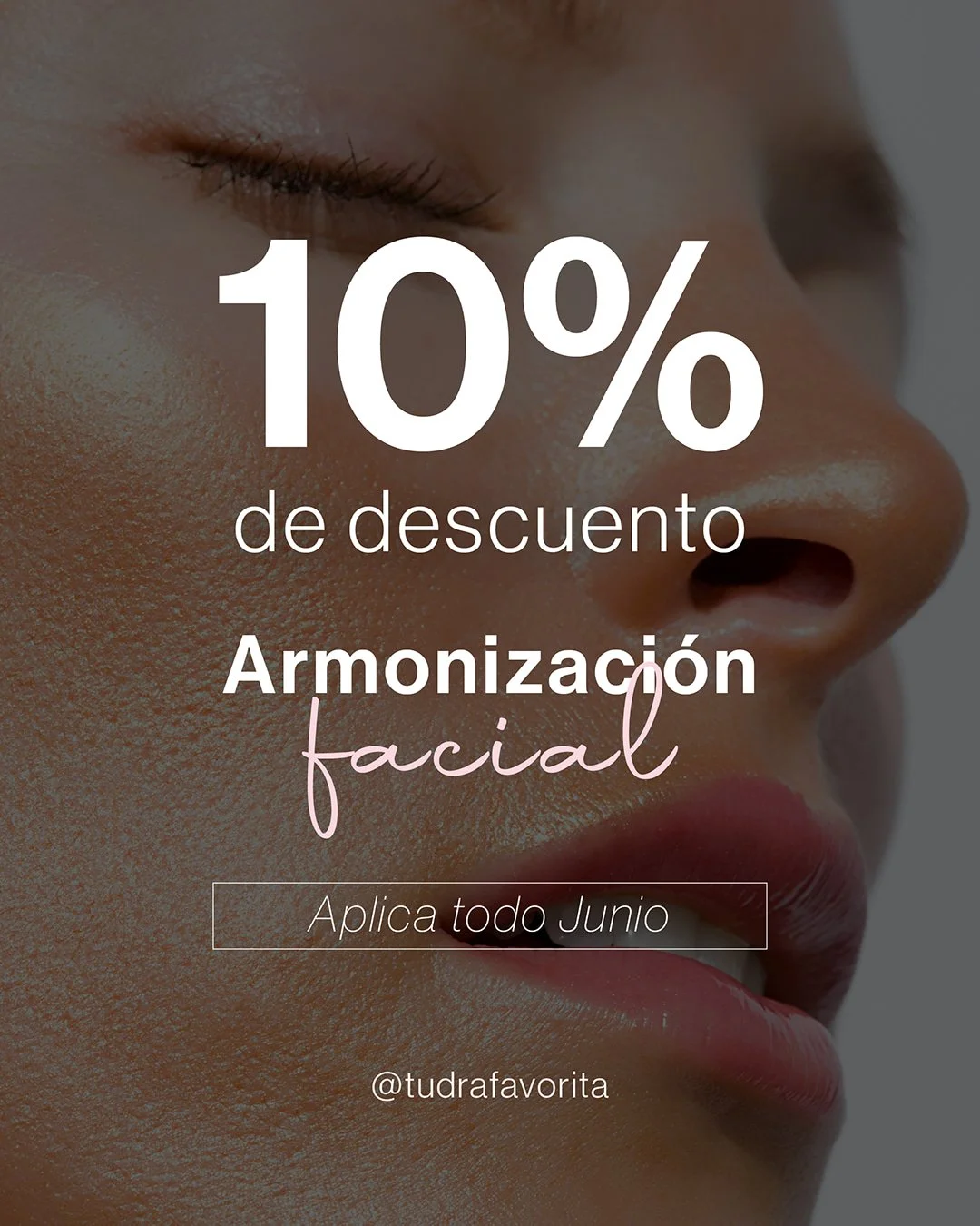 ✨ Junio es tu mes.

Date el regalo de verte y sentirte como siempre has querido. La Armonizaci&oacute;n Facial tiene un 10% de descuento, todo el mes de junio. 

📅 Agenda tu consulta y te cuento todo lo que podemos hacer por ti. 

#resultadosnatural