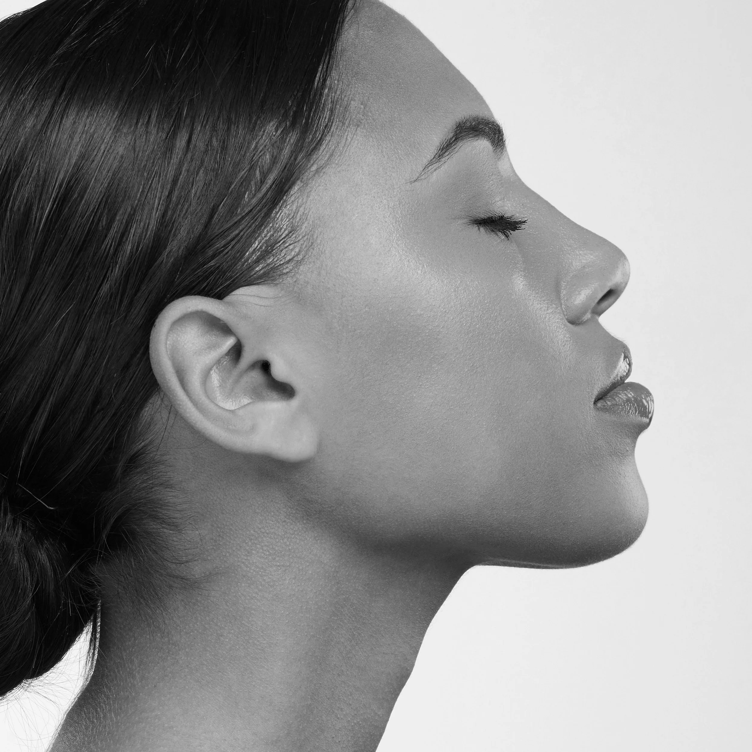 Armonización Facial