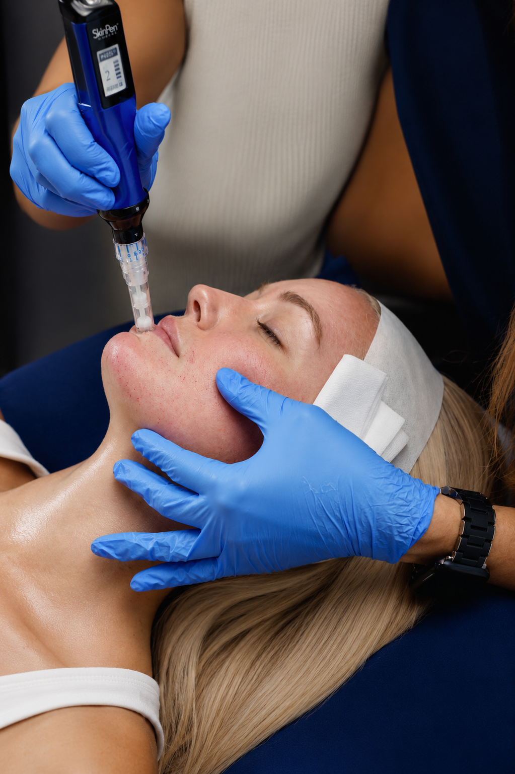 A woman with fair skin and blonde hair lying down with her eyes closed, receiving a facial treatment with a syringe. She is wearing a white headband, and a person in blue gloves is administering the treatment to her face. The person performing the procedure is wearing a beige top and a black watch.