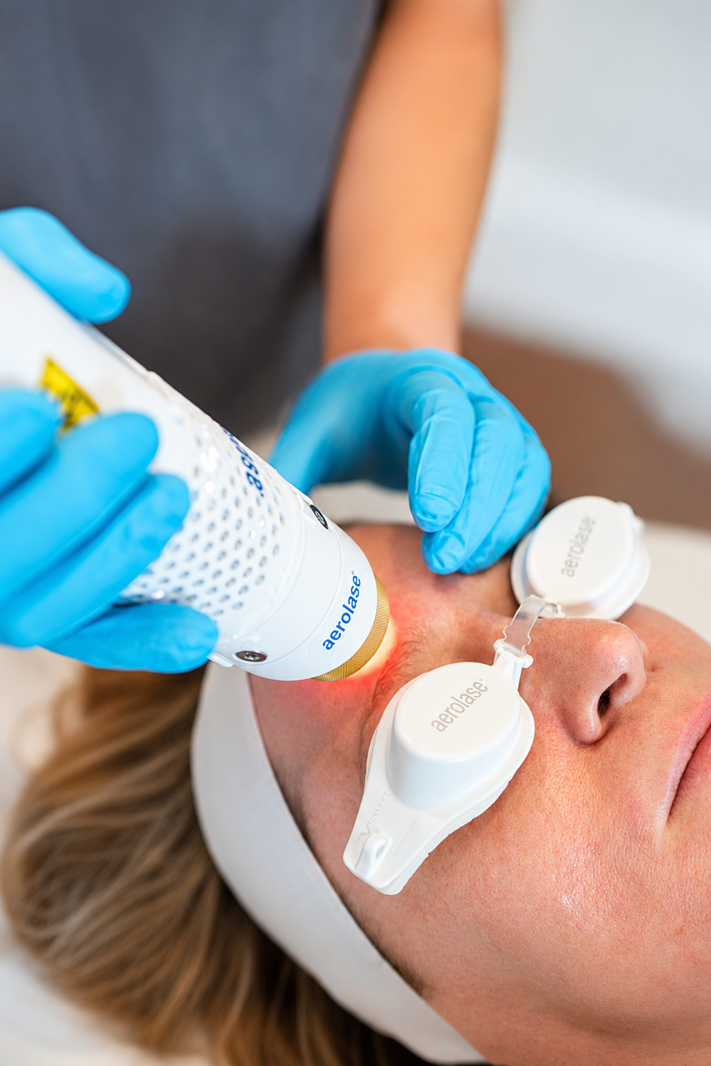 A person receiving laser skin treatment on their face, wearing protective goggles, with a healthcare professional holding a device emitting red light.