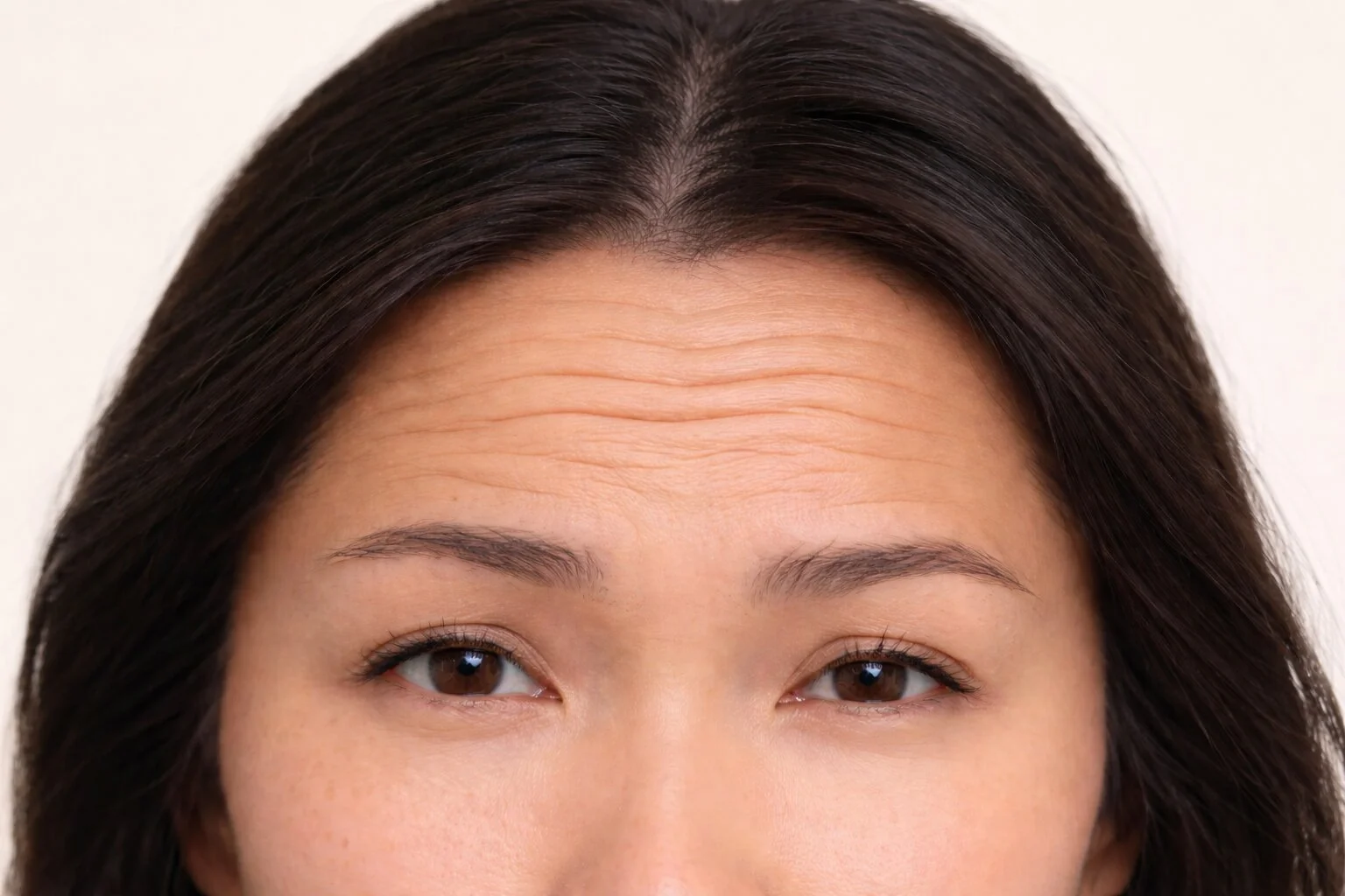 4. Botox Page Before.jpg