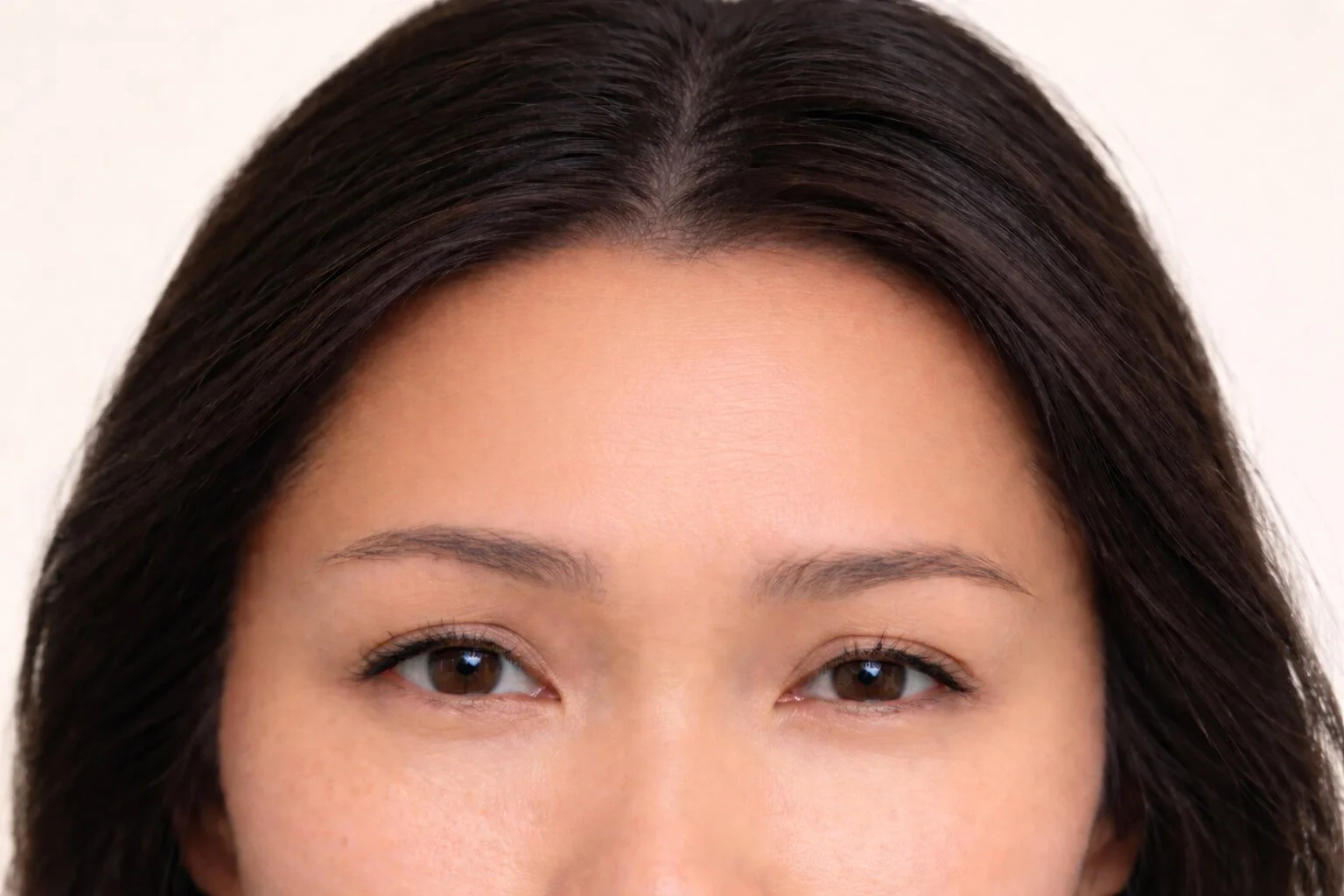 3. Botox Page After.jpg