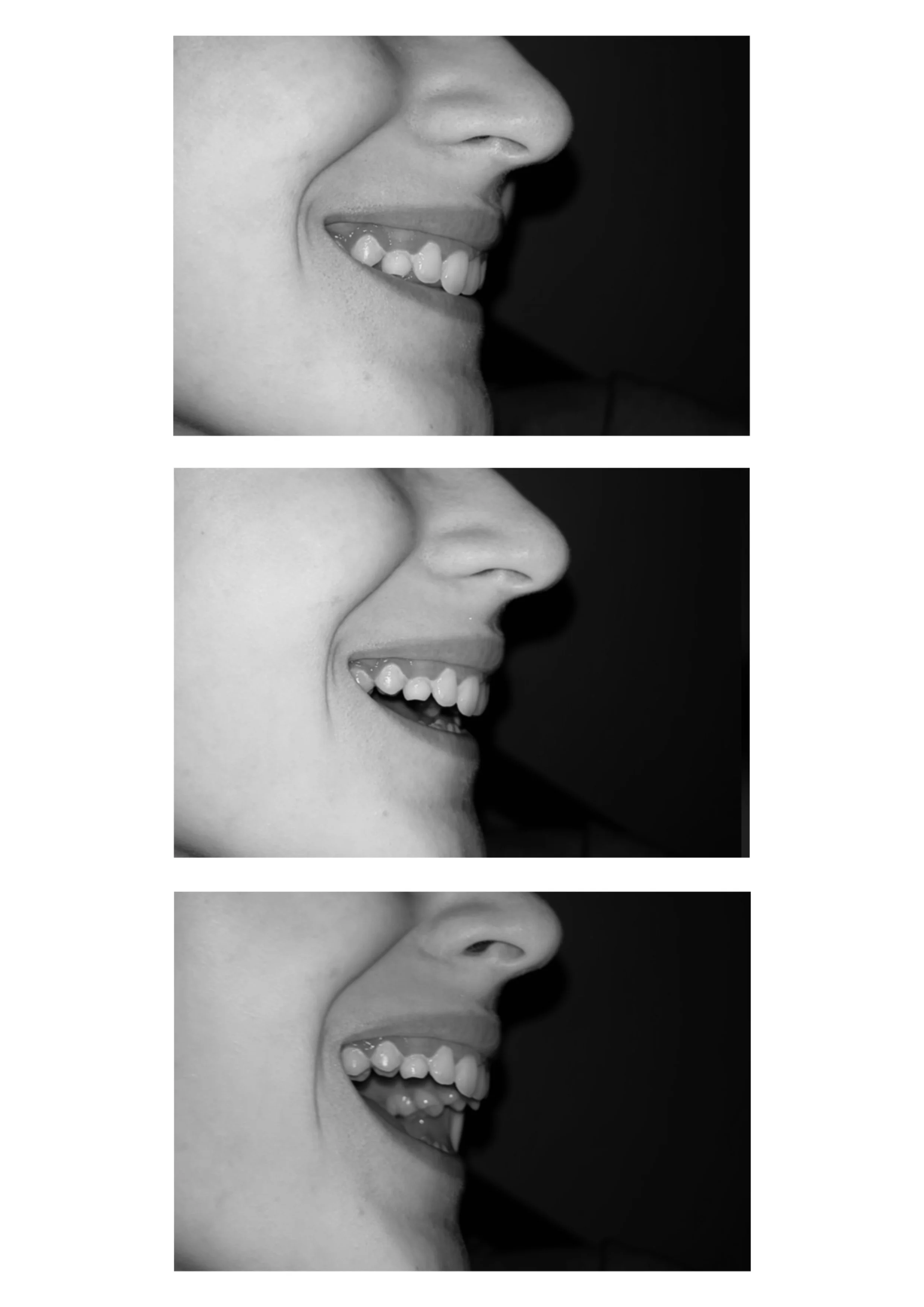 When I Smile With My Teeth (2023)
Ciara L Campbell
Photography print
42cm x 29.7cm