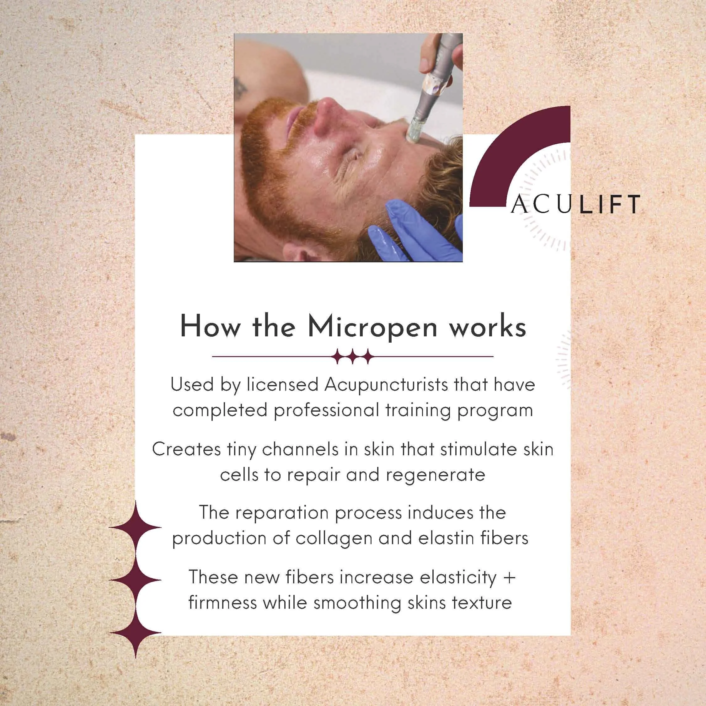 Aculift how the micropen works