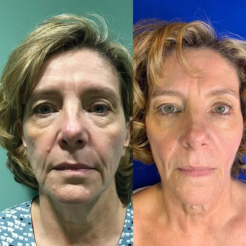 Medspa in Austin, TX 78746 | Threads Near Me