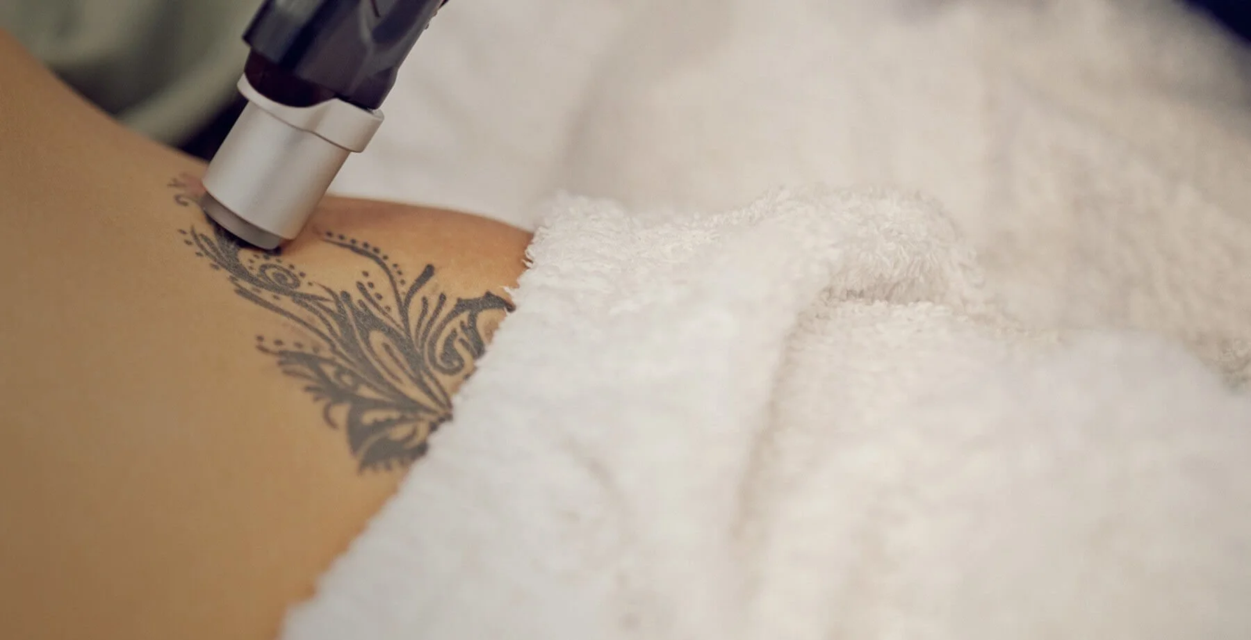 Medspa in Austin, TX 78746 | Tattoo Removal Near Me.jpeg