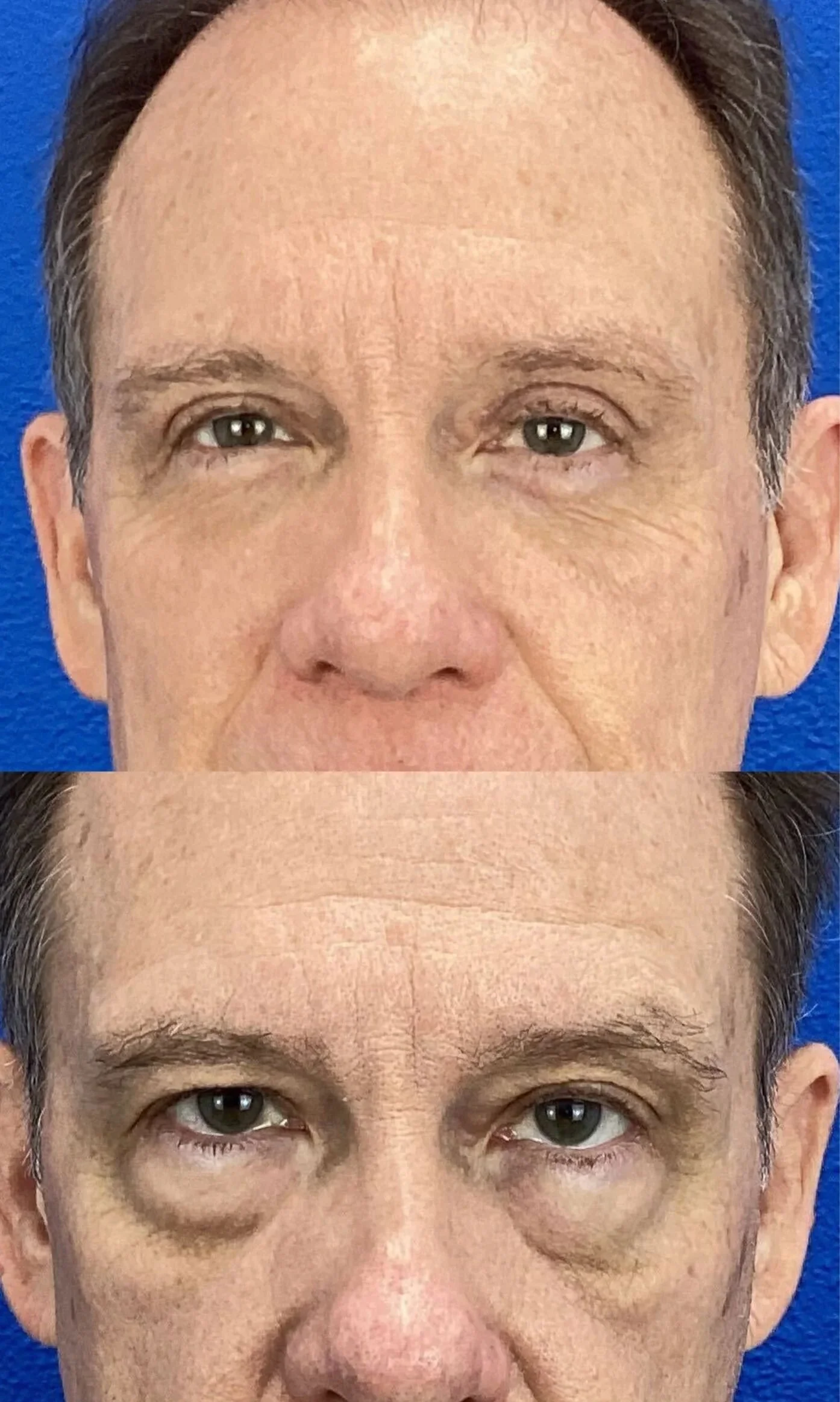 Medspa in Austin, TX 78746 | Blepharoplasty Near Me.jpg