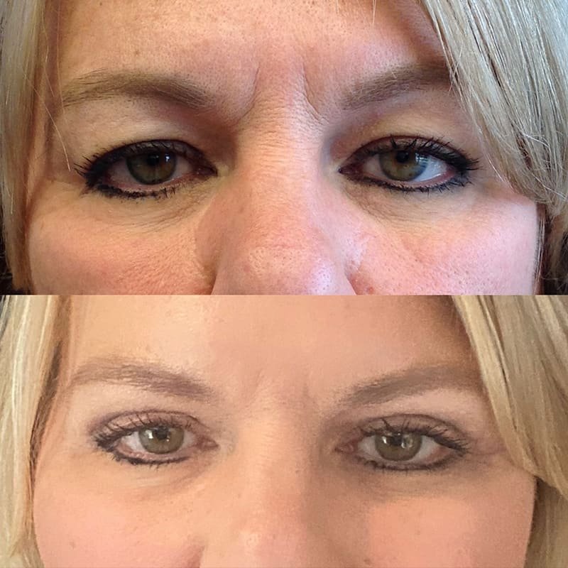 Medspa in Austin, TX 78746 | Eye Surgery Near Me.jpg