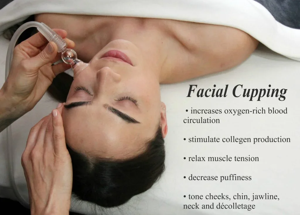 cupping.webp