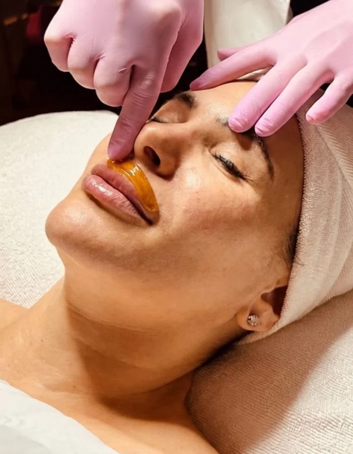 Female client gets upper lip sugared during a hair removal service in McKinney