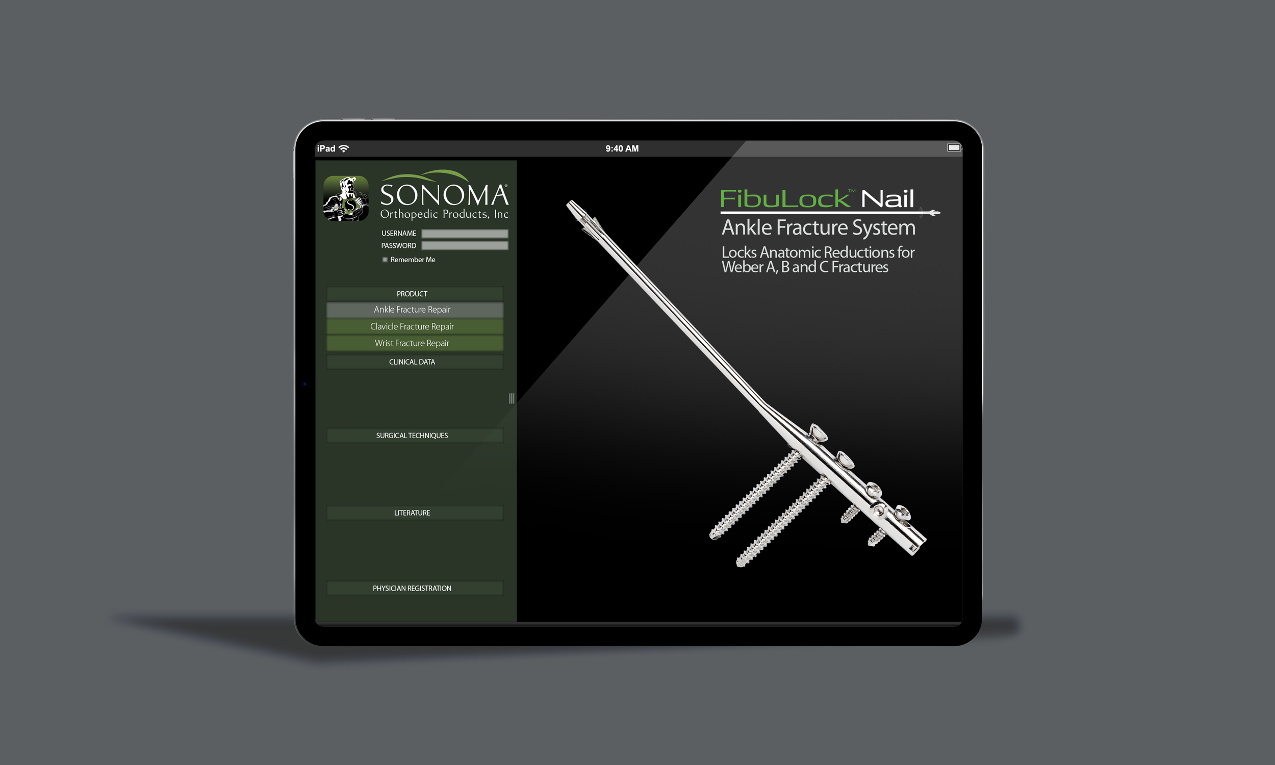 Screenshot of a medical app interface for Sonata Orthopedic Products, Inc., focusing on a product called FibuLock Nail, an ankle fracture system. The screen includes login fields and menu options like ankle, clavicle, wrist fracture repair, clinical data, surgical techniques, literature, and physician registration.