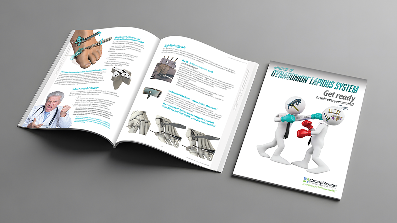 A brochure about the Dynamition Lapidus System for bunion surgery featuring a cartoon graphic of two figures boxing with surgical tools, alongside images and text about medical procedures, foot surgery, and tools.