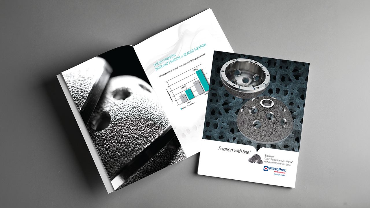 Brochure featuring orthopedic implants, with images of dental or surgical metal components and a graph showing strength data.