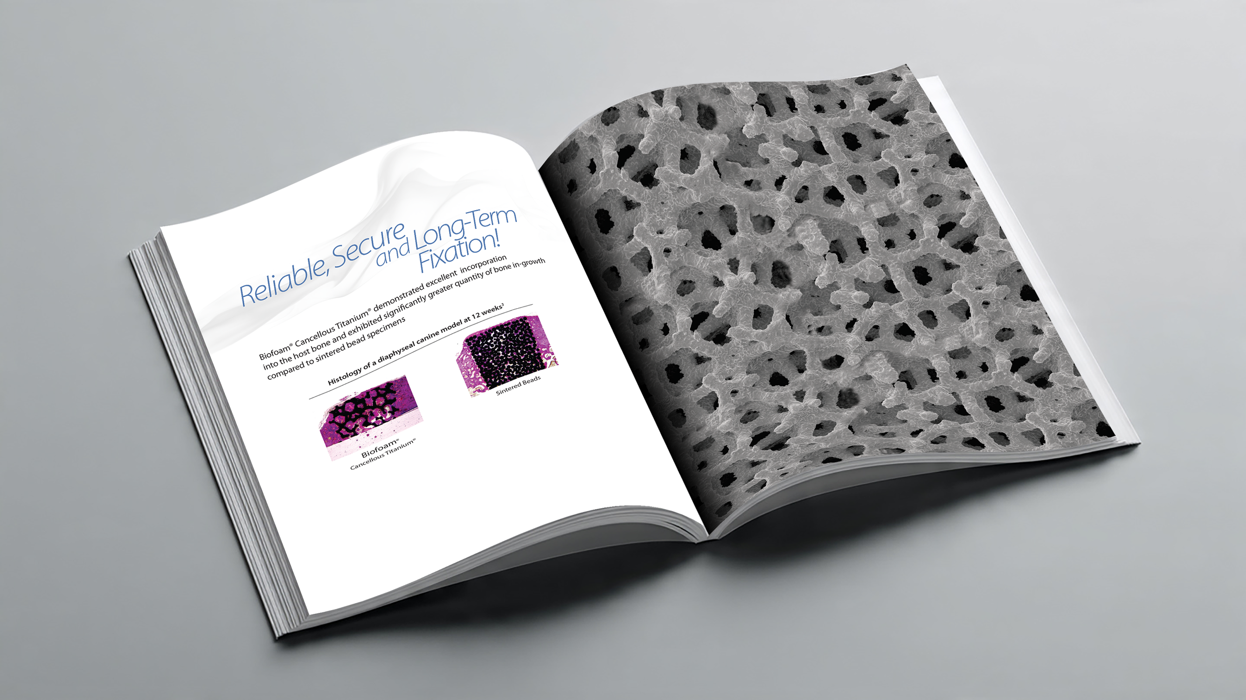 Open magazine showing text about long-term fixation and images of bone histology, with a close-up of a textured black and gray surface on the adjacent page.