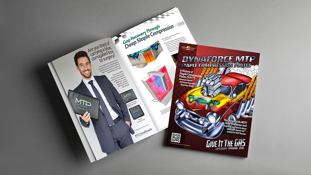 A brochure for DynaForce MTP Staple Compression Plates with a cartoon car on the cover, featuring tires, engine, and tools. An open magazine shows a man in a suit holding a tablet and discussing products related to deep staple compression and medical devices.