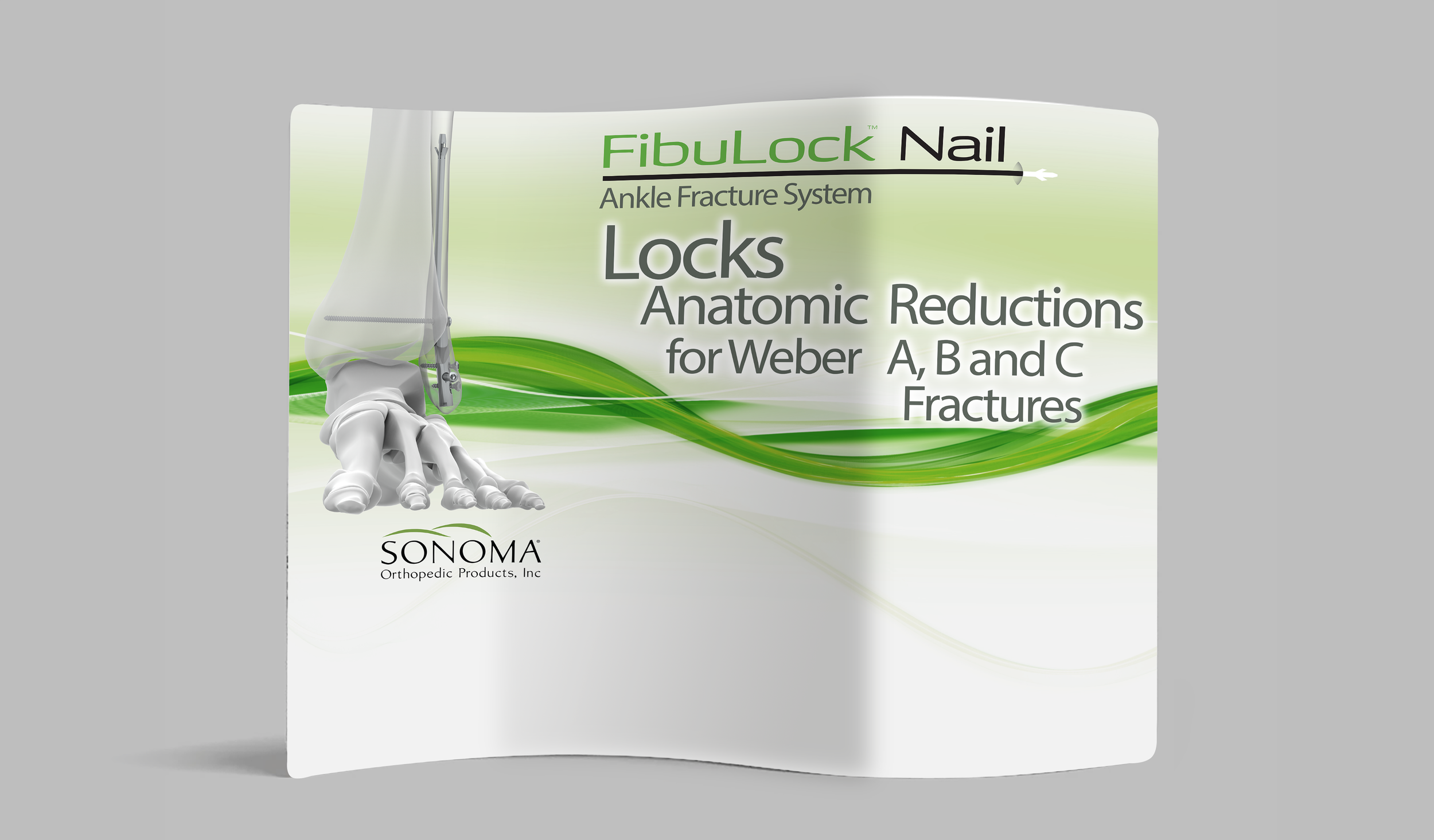 Packaging for FibuLock Nail, an ankle fracture system by Sonoma Orthopedic Products, Inc., featuring a green and white design, a stylized hospital hand illustration, and information about its use for Weber A, B, and C fractures.