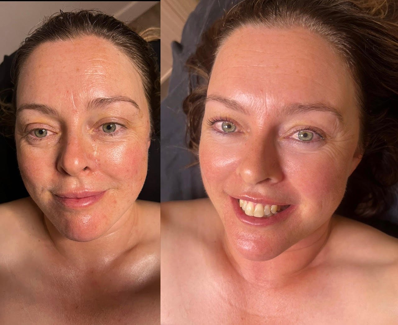 Side-by-side photos of a woman with clear skin, showing a before and after makeup or skincare transformation, smiling in the right photo.