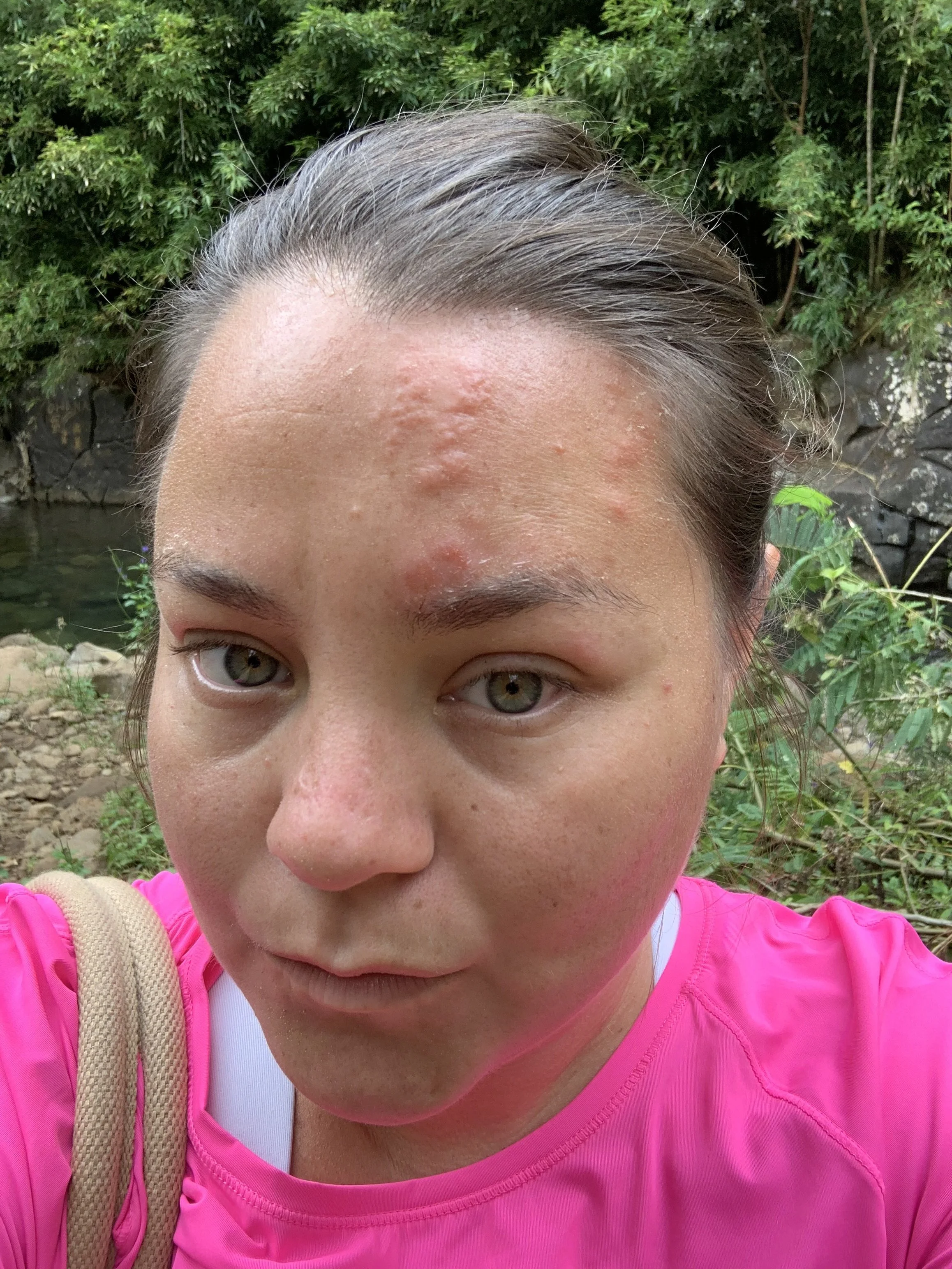 shingles.jpg