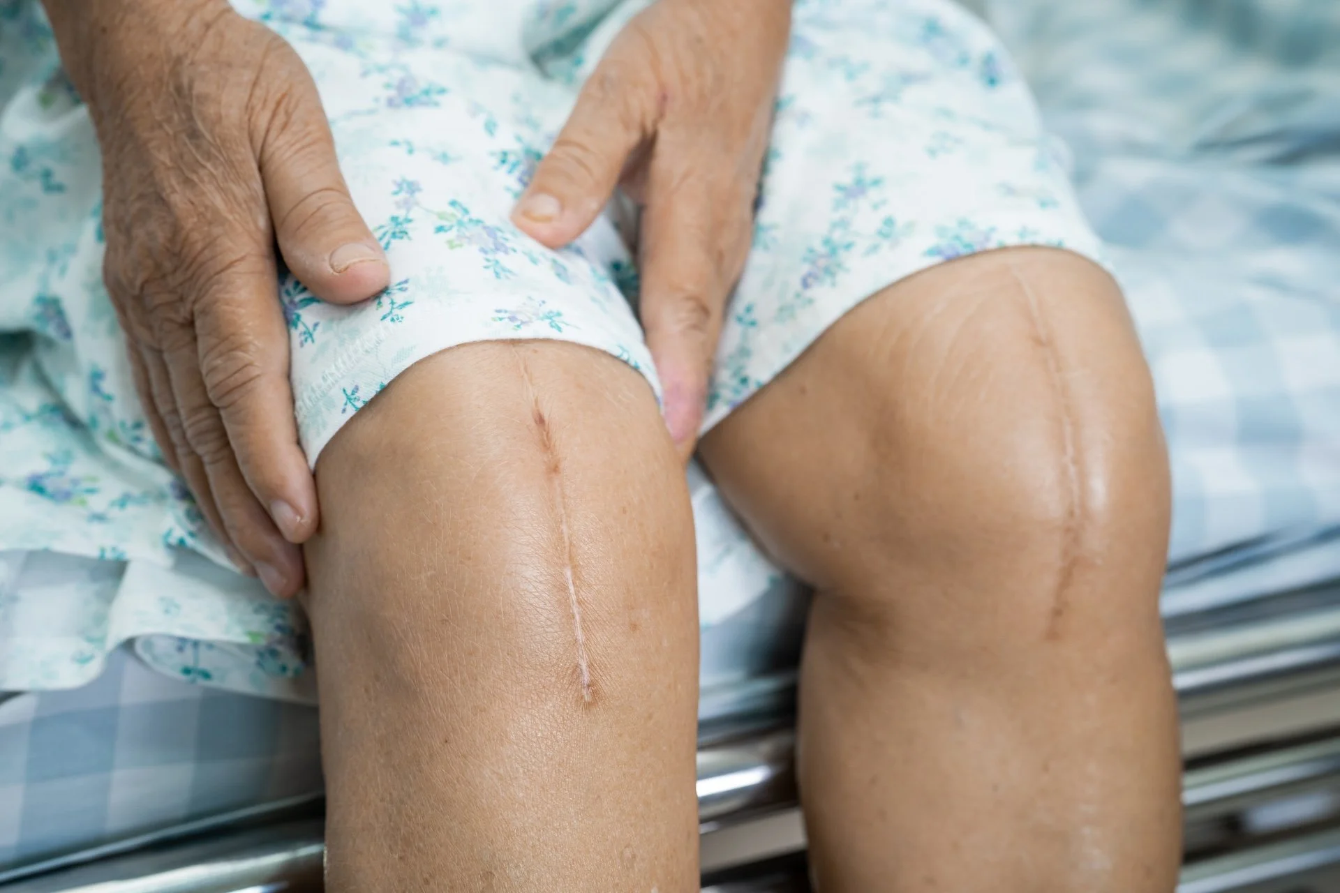 What Is Scar Therapy?