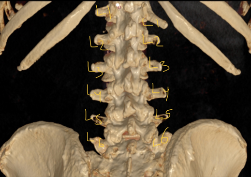 LUMBAR SPINE T11 RIBLETS