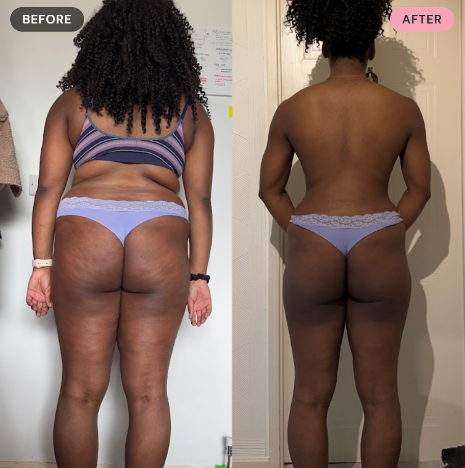 Side-by-side comparison of a woman's back before and after a transformation. In the before image, she is wearing a striped tank top and purple underwear, with visible body fat and loose skin. In the after image, she is topless with a more toned appearance, standing against a door with her hands behind her back, showcasing a slimmer and more defined back and legs.