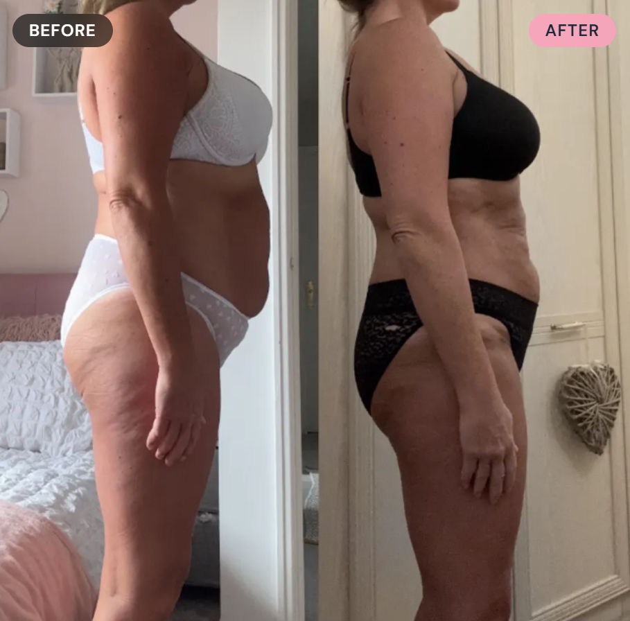 Side-by-side comparison of a woman before and after weight loss, showing a slimmer physique, in a bedroom with different lingerie in each photo.