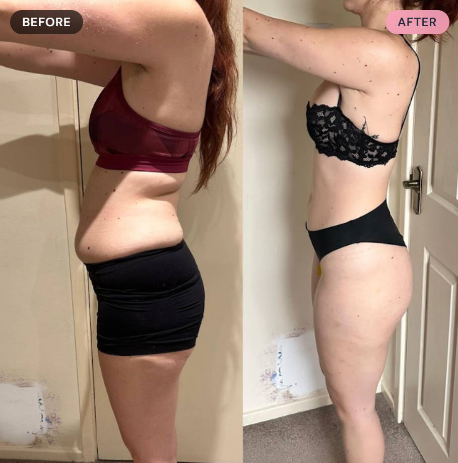 Comparison of a woman's side profile before and after weight loss or body transformation, with the left side labeled 'BEFORE' showing more body fat and the right side labeled 'AFTER' showing a slimmer physique.