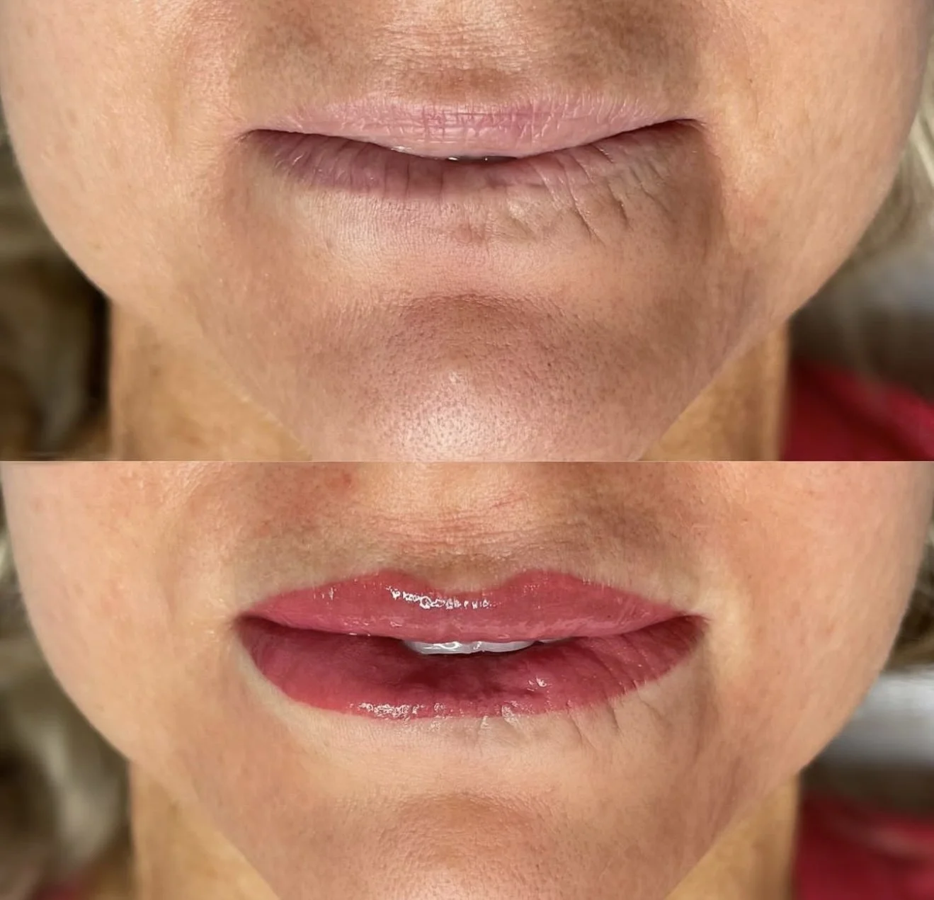 Close-up of a woman's lips, showing a before and after comparison of lip cosmetic treatment: rough, dry lips above and smooth, glossy lips below.