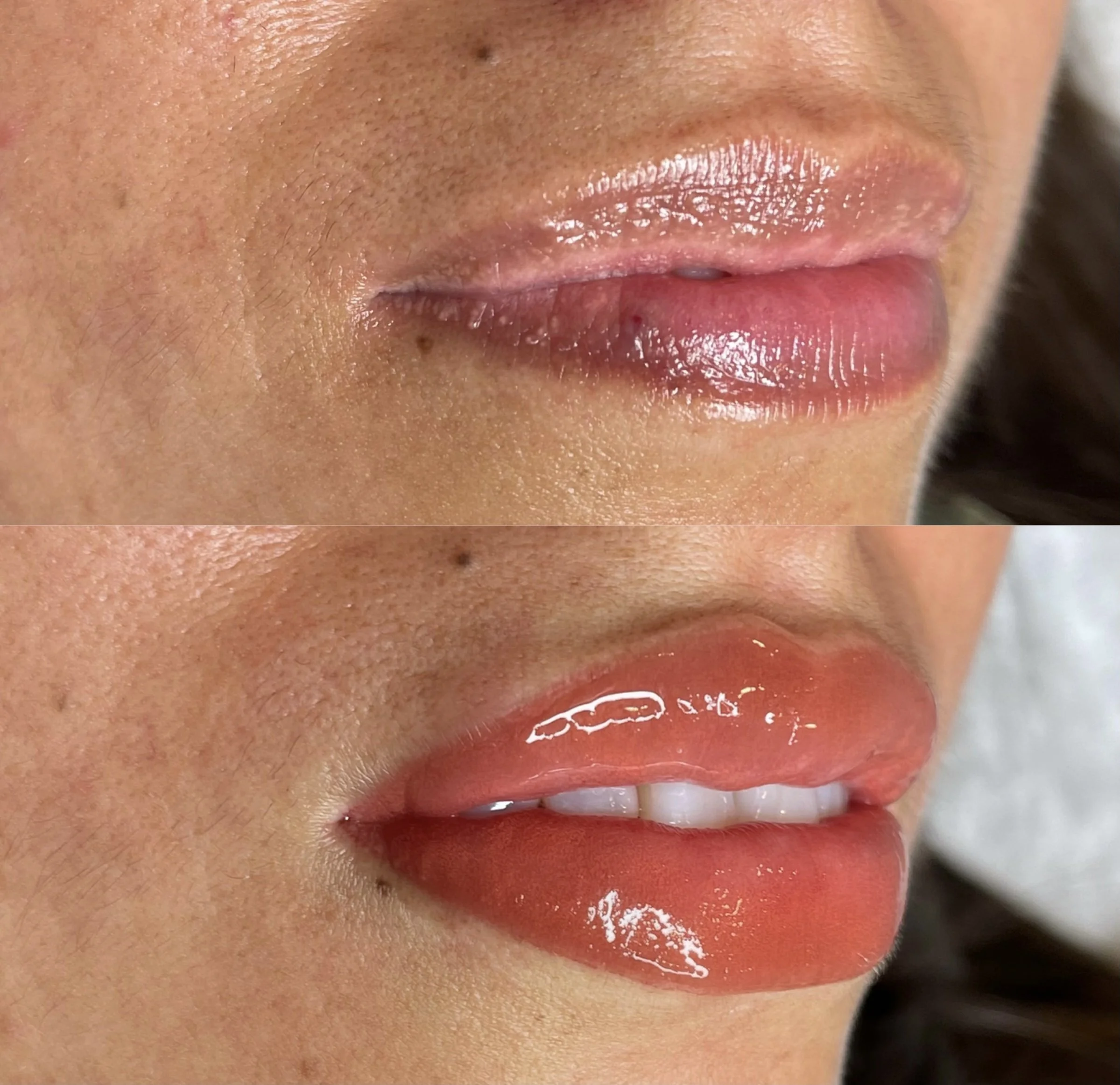 Close-up of a person's lips with shiny lip gloss, showing skin texture and small facial moles near the lips.