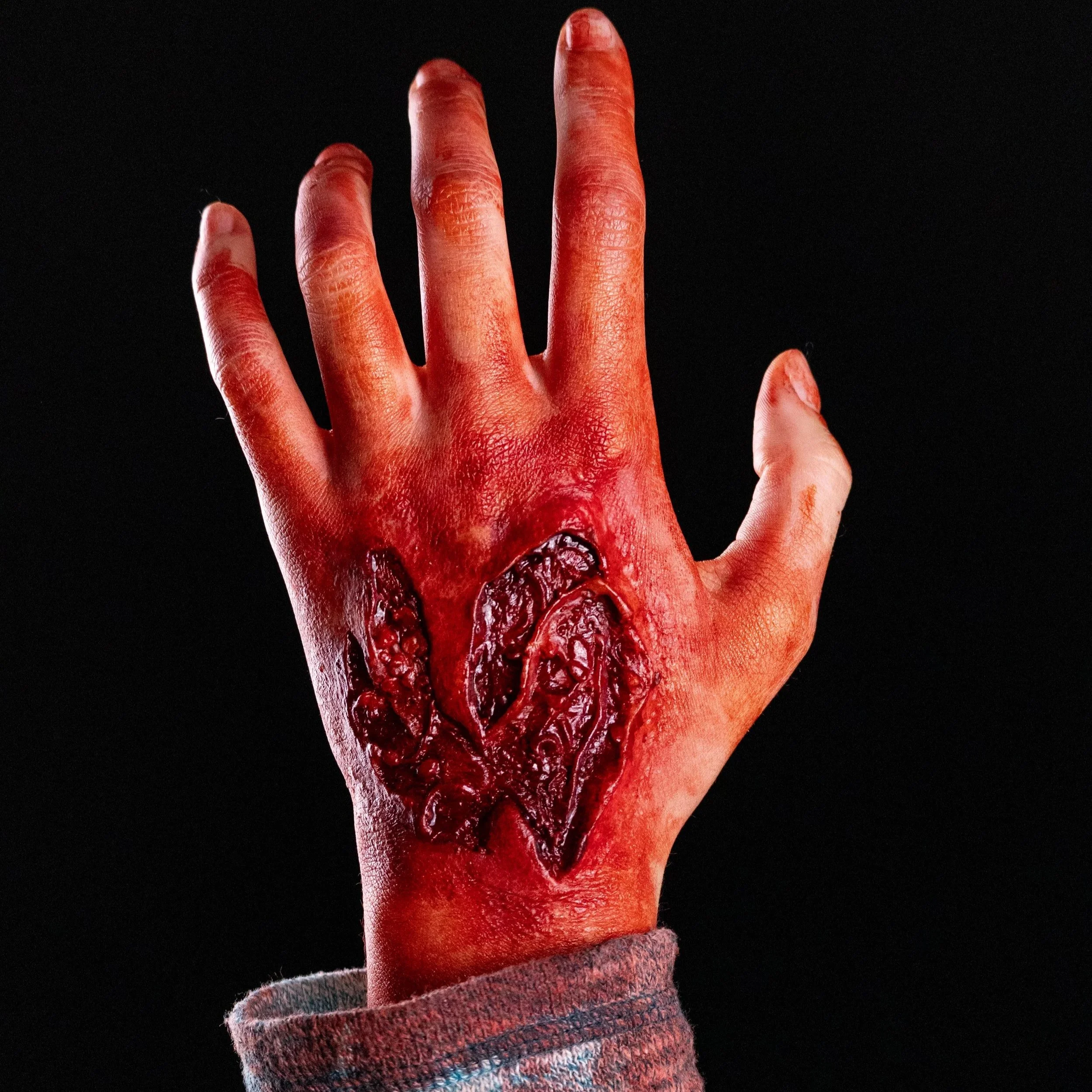 Prosthetic Transfer Material