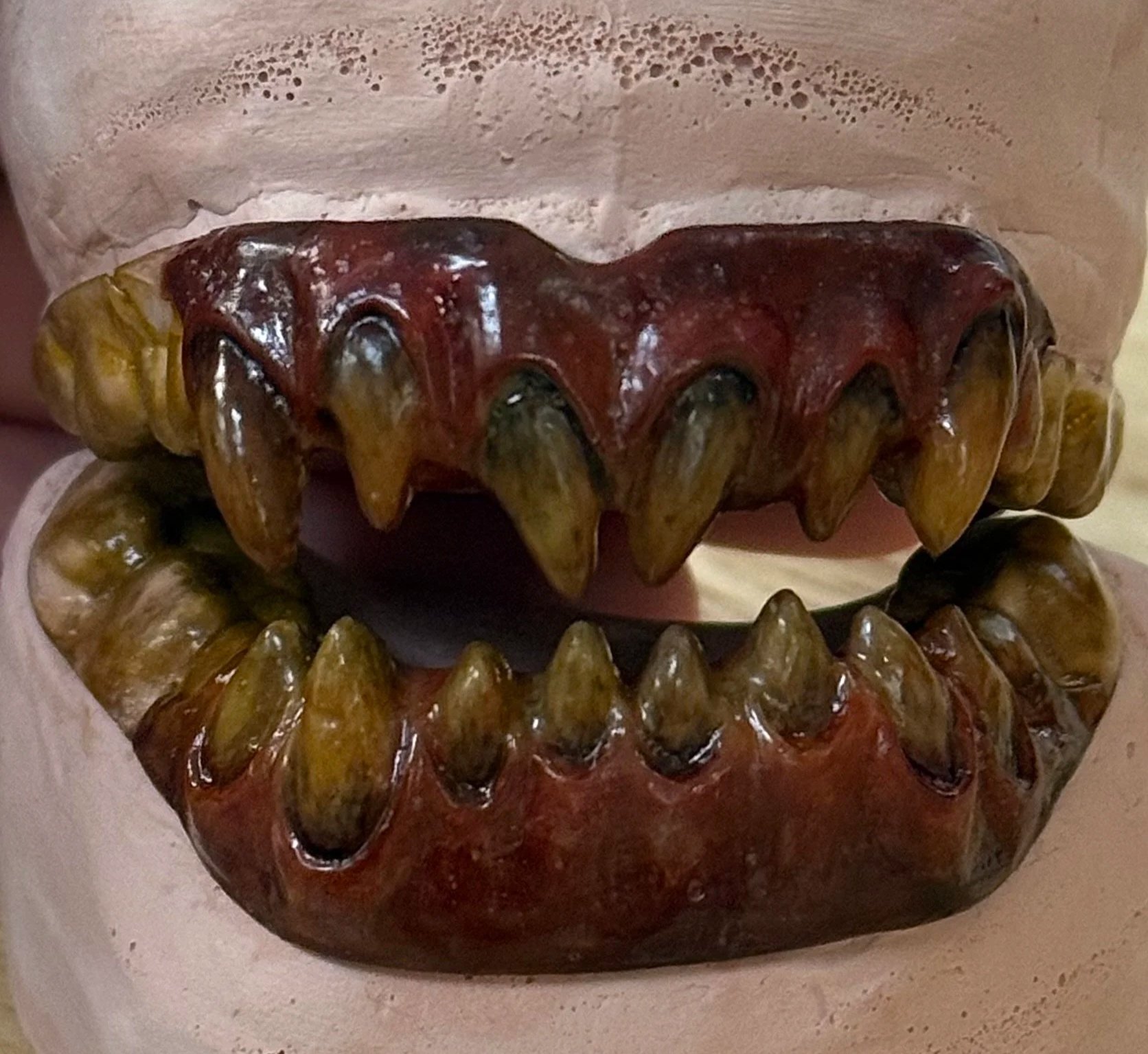 Dentures