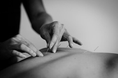 Acupuncture treatment to support pain relief, healing, and wellness at Enliven Acupuncture