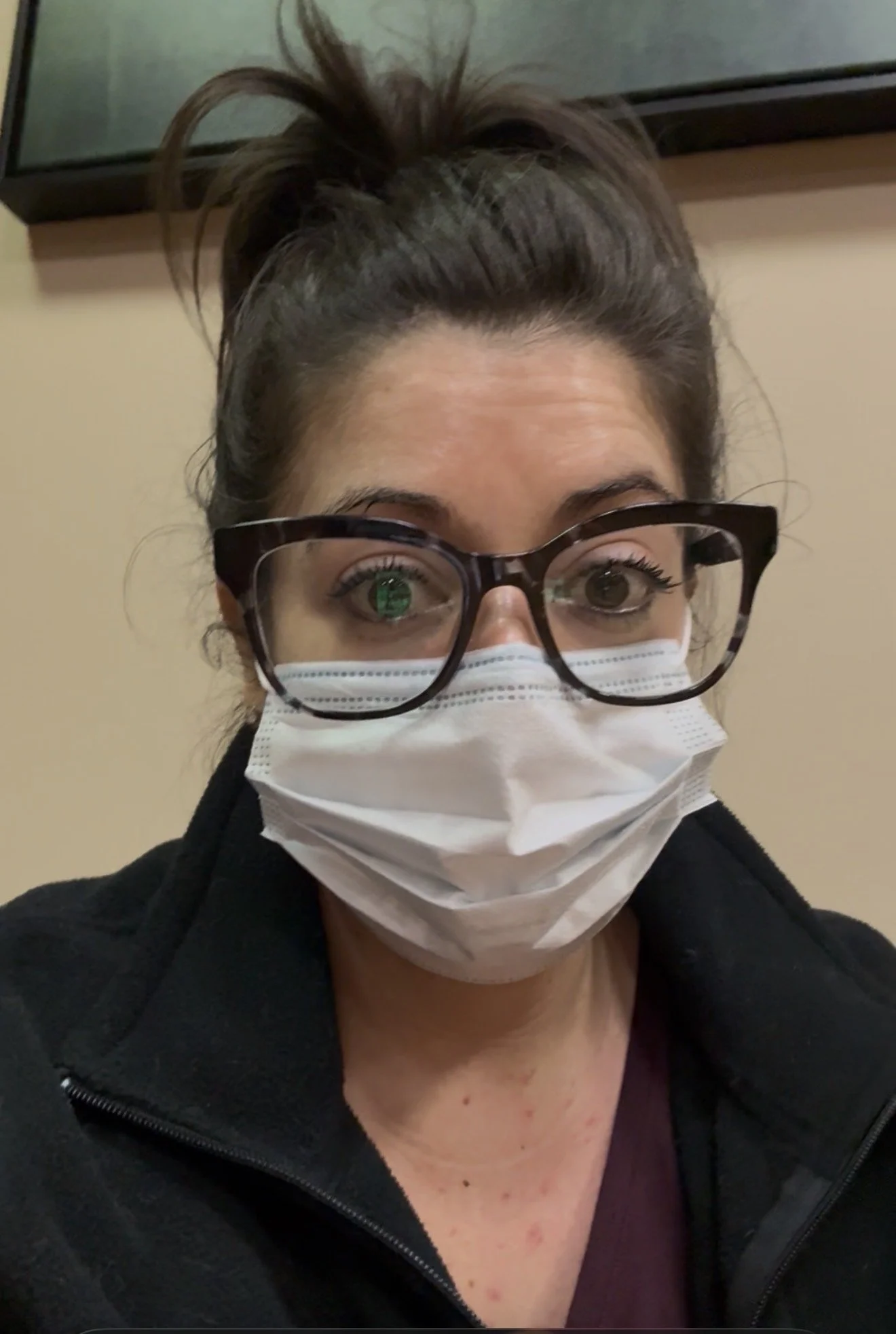 Angie from @diagnosis_cirrhosis wearing her first pair of prescription glasses before understanding the liver's role in eyesight changes.