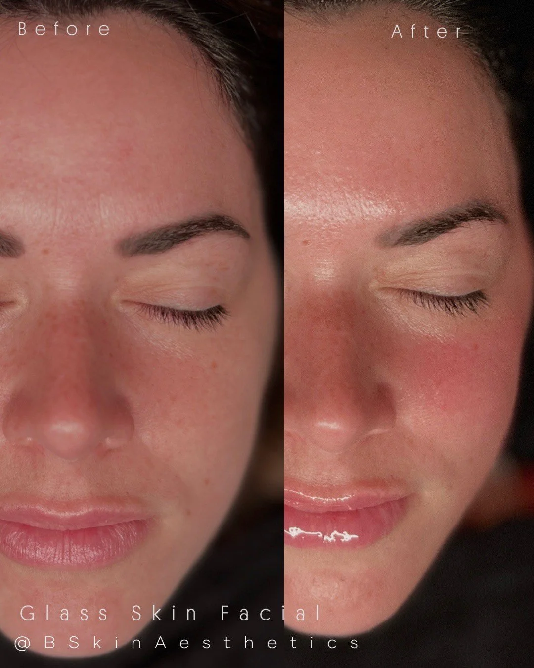 Post Oxygenating Facial 