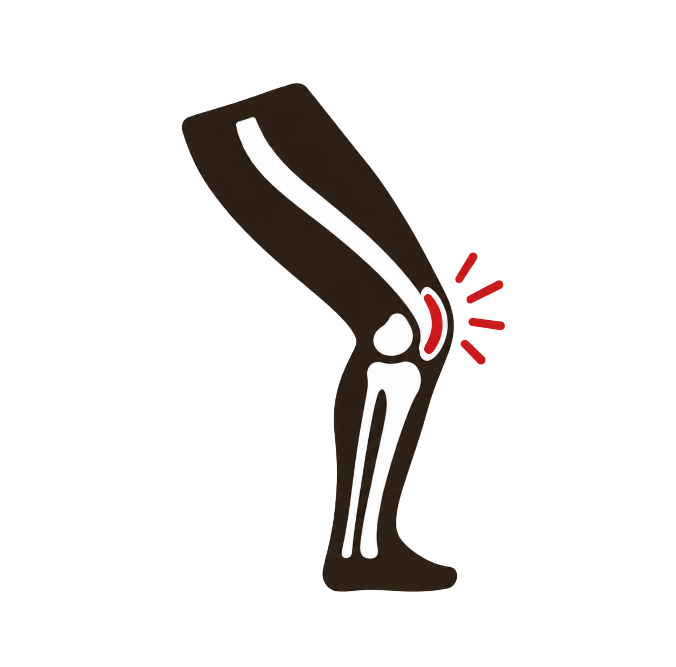 IT Band Syndrome