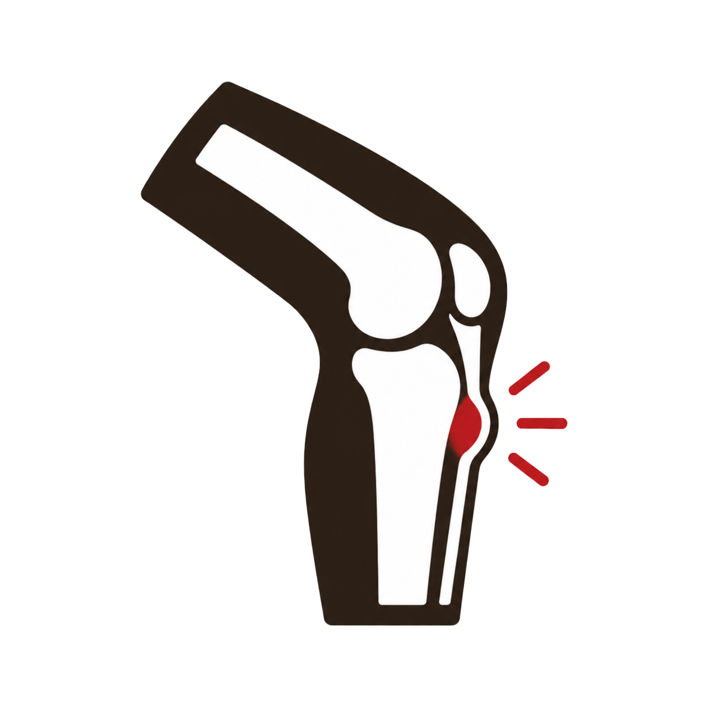 Osgood-Schlatter Disease