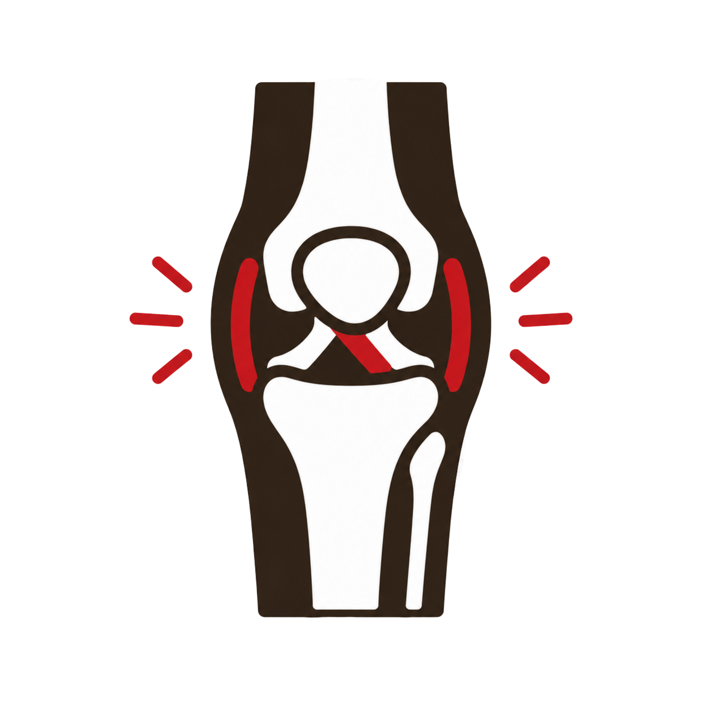 Knee Ligament Sprains (MCL, LCL &amp; ACL)