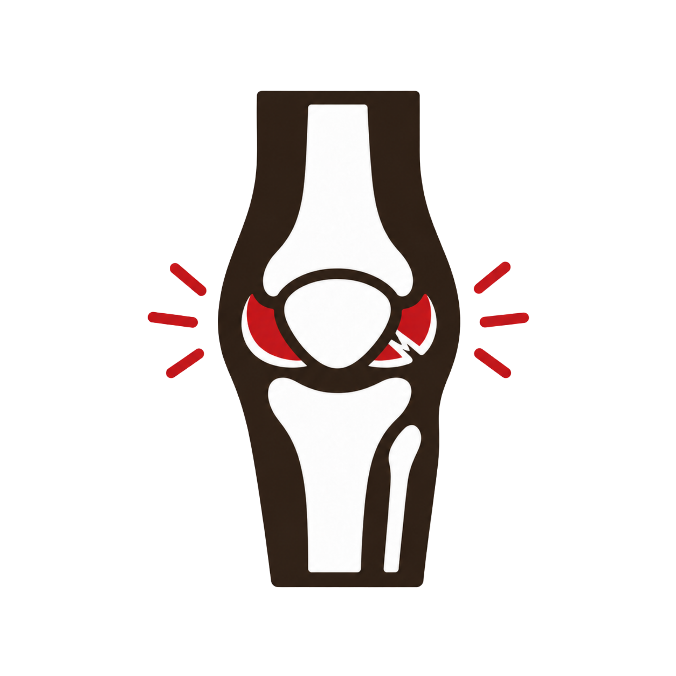 Meniscus Tears