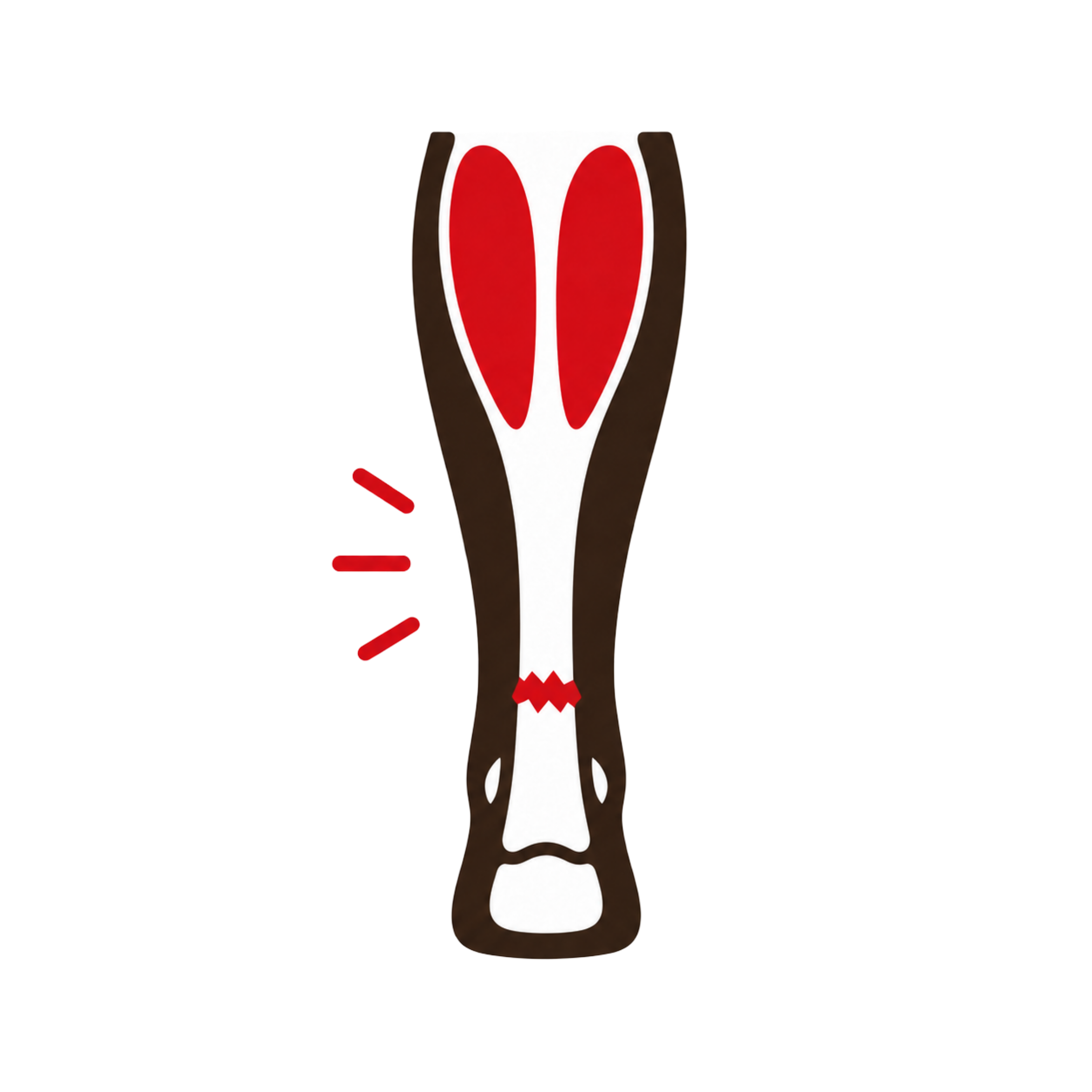 Achilles Tendon Rupture