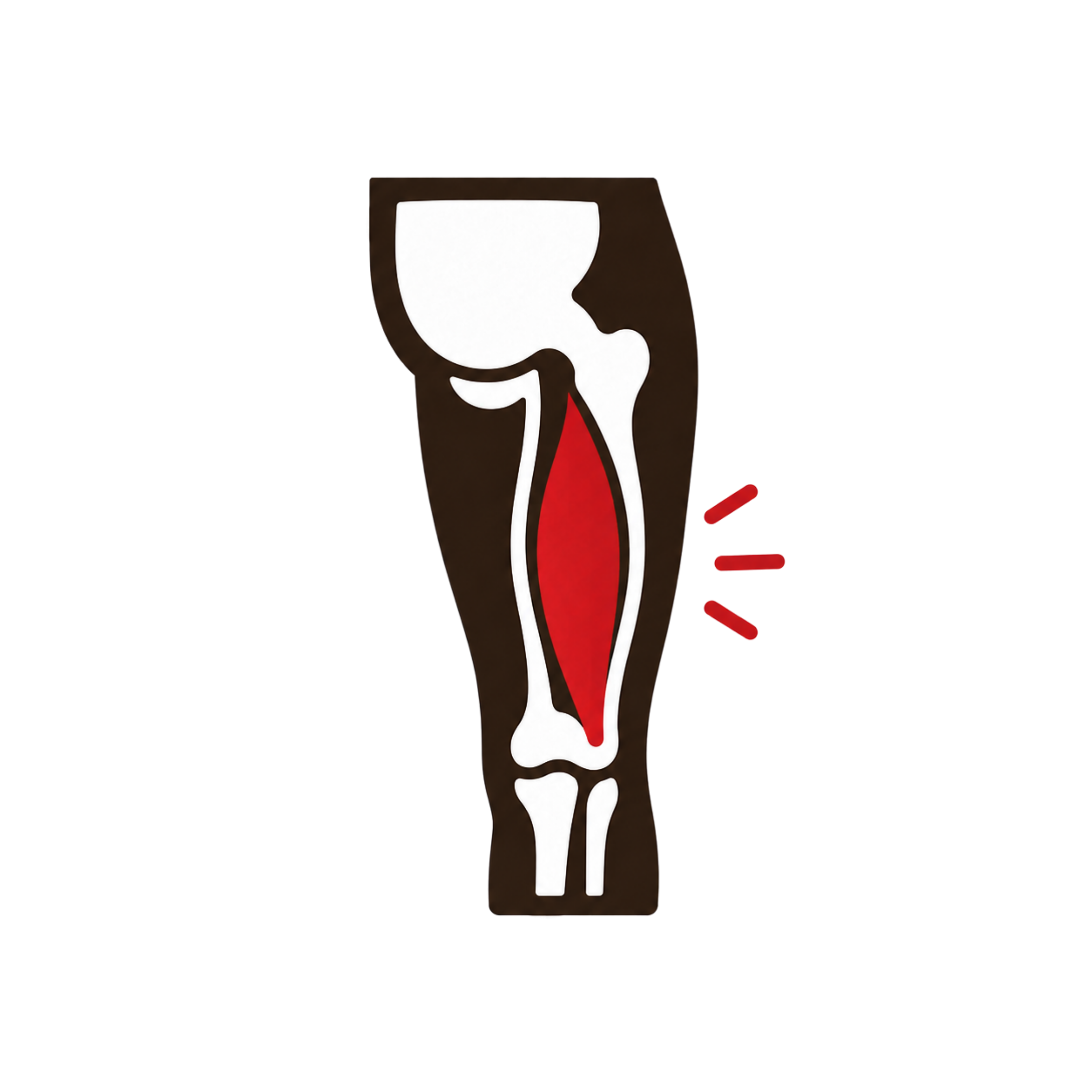 Hamstring Strains