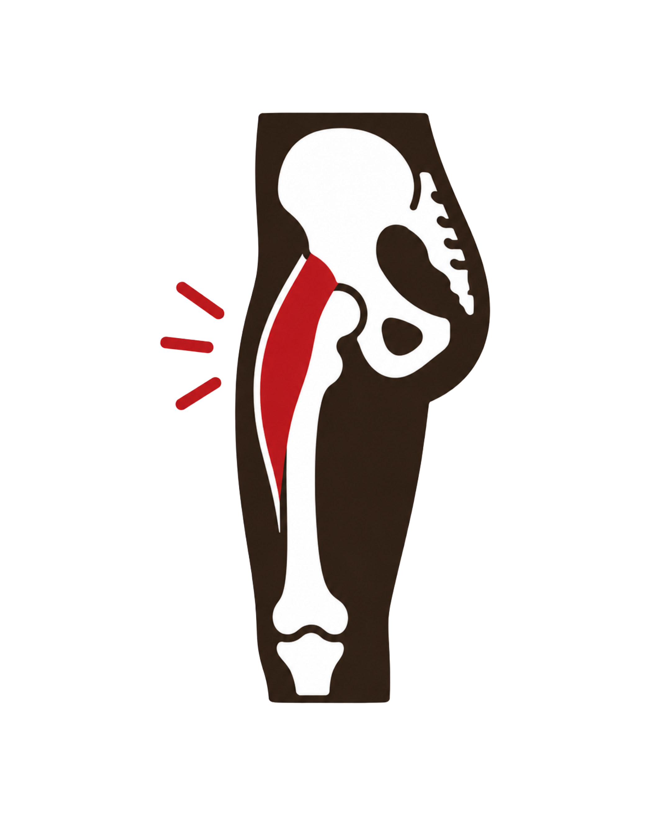 Hip Flexor Strain