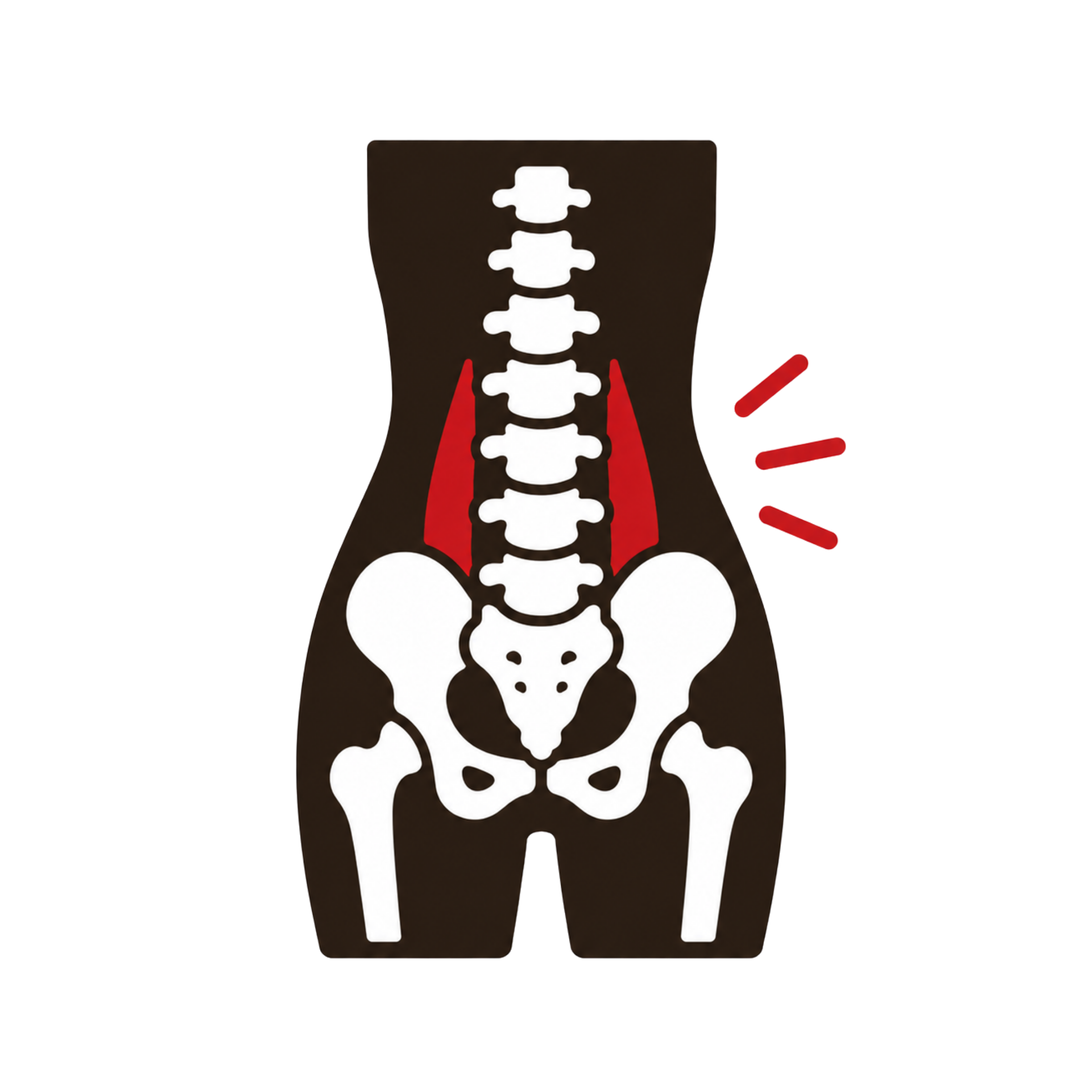 Lumbar Strain