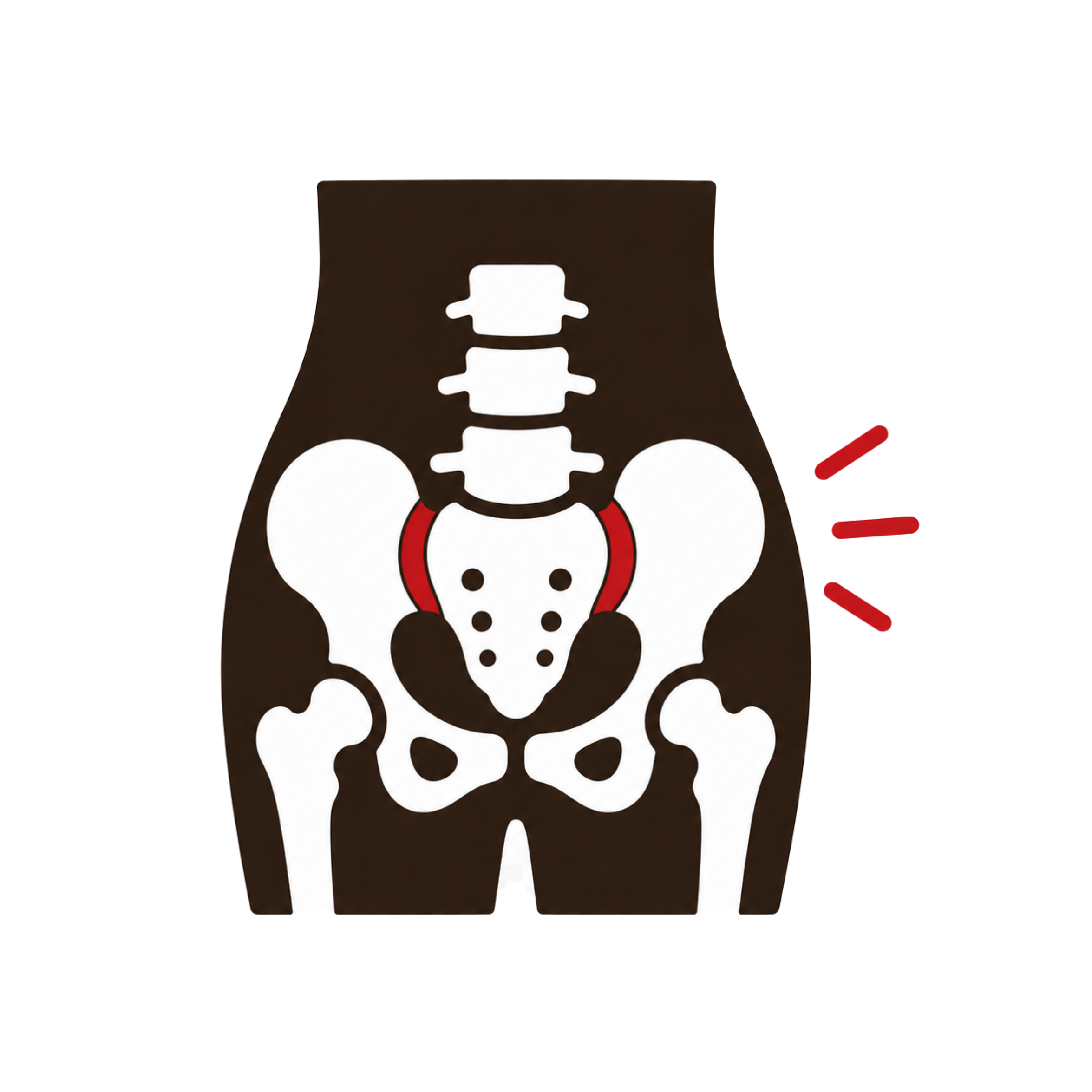 Sacroiliac Joint Dysfunction