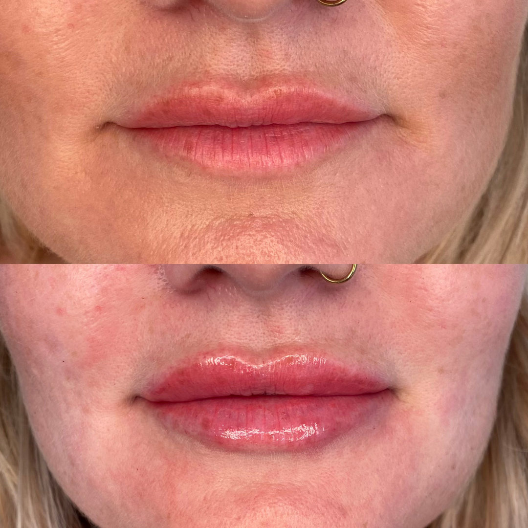 Close-up of a woman’s lips before and after applying clear gloss, with a gold nose ring visible.