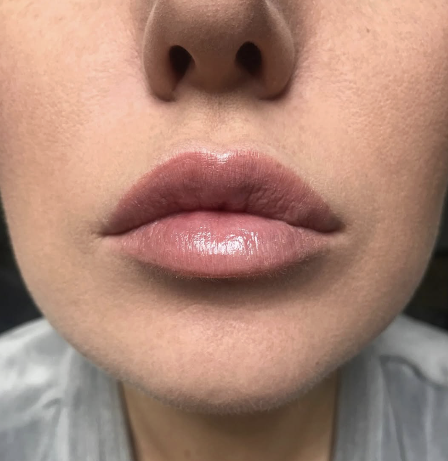 Close-up of a person's lips with natural lip color and smooth skin around the mouth.